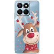 Прозорий чохол BoxFace Honor 400 Smart Winter Deer
