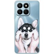 Прозорий чохол BoxFace Honor 400 Smart Husky