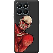 Чорний чохол BoxFace Honor 400 Smart Титан