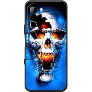 Чохол BoxFace Infinix Hot 70 