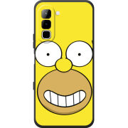 Чохол BoxFace Infinix Hot 70 