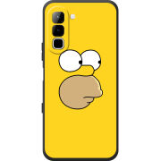 Чохол BoxFace Infinix Hot 70 