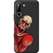 Чорний чохол BoxFace Infinix Hot 70 Титан