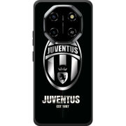 Чохол BoxFace Blackview Shark 6 