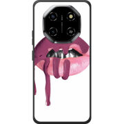 Чохол BoxFace Blackview Shark 6 