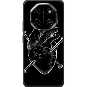 Чохол BoxFace Blackview Shark 6 