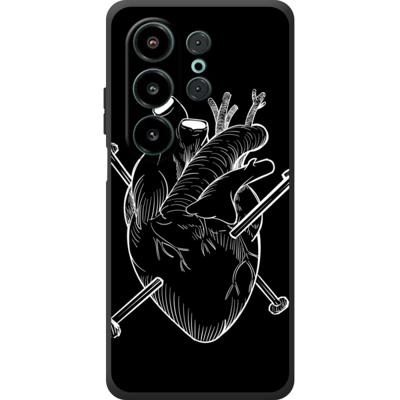 Чохол BoxFace Blackview Wave 10 