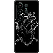 Чохол BoxFace Blackview Wave 10 