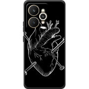 Чохол BoxFace Realme 15 5G 