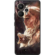 Чохол BoxFace Realme 15 5G 