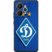 Чохол BoxFace Realme 15 5G Динамо Киев