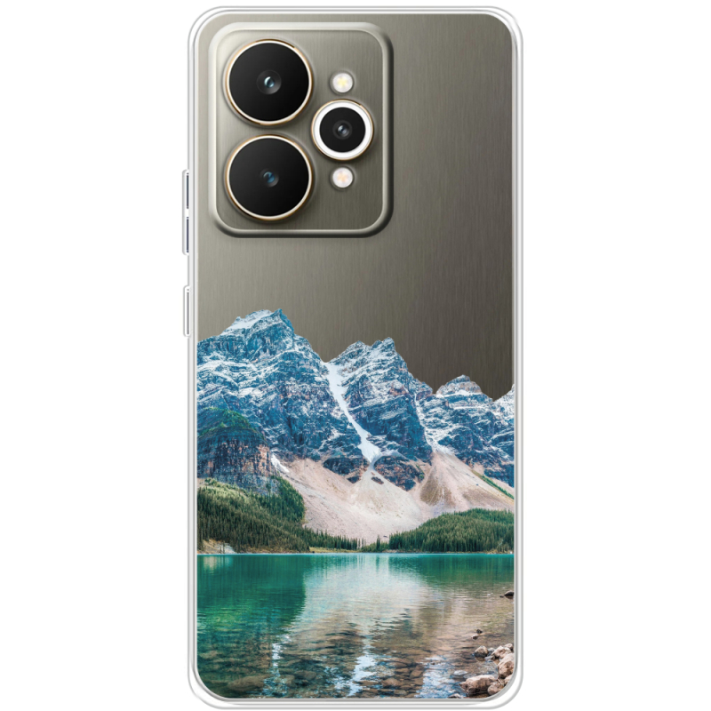 Прозорий чохол BoxFace Realme 15 5G Blue Mountain