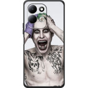 Чохол BoxFace Xiaomi Redmi 17 
