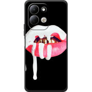 Чохол BoxFace Xiaomi Redmi 17 