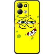 Чохол BoxFace Xiaomi Redmi 17 