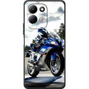 Чохол BoxFace Xiaomi Redmi 17 