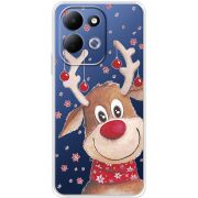 Прозорий чохол BoxFace Xiaomi Redmi 17 Winter Deer