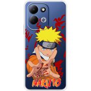 Прозорий чохол BoxFace Xiaomi Redmi 17 Naruto