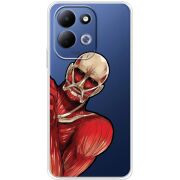 Прозорий чохол BoxFace Xiaomi Redmi 17 Титан