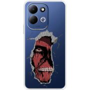 Прозорий чохол BoxFace Xiaomi Redmi 17 Нападение Титана