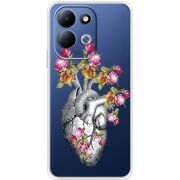 Чохол зі стразами Xiaomi Redmi 17 Heart