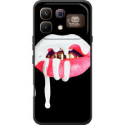 Чохол BoxFace Infinix Note 60 Pro 