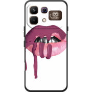 Чохол BoxFace Infinix Note 60 Pro 