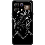Чохол BoxFace Infinix Note 60 Pro 