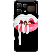 Чохол BoxFace Infinix Note 60 