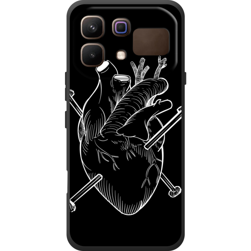 Чохол BoxFace Infinix Note 60 