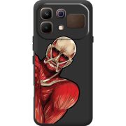 Чорний чохол BoxFace Infinix Note 60 Титан
