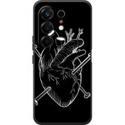 Чохол BoxFace Tecno Camon 50 