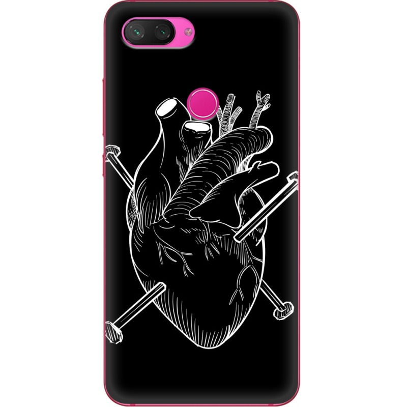 Чехол Uprint Xiaomi Mi 8 Lite 