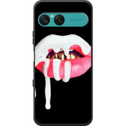 Чохол BoxFace Sony Xperia 10 VII 