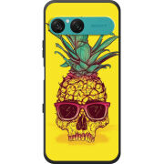 Чохол BoxFace Sony Xperia 10 VII Pineapple Skull