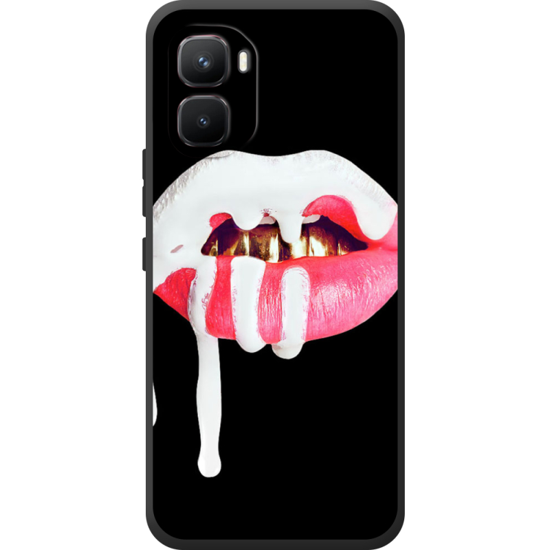 Чохол BoxFace Infinix GT 50 Pro 