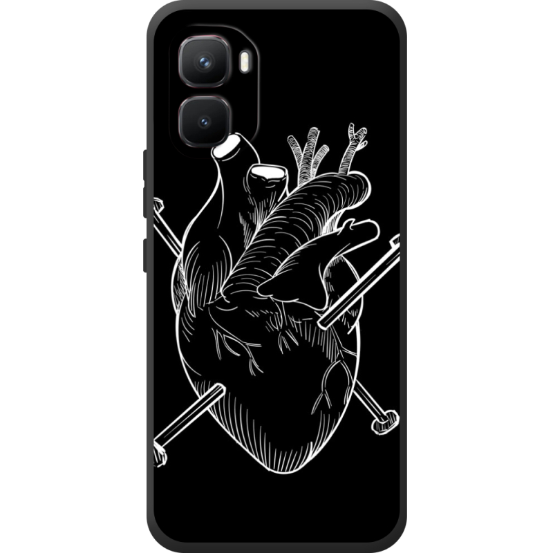 Чохол BoxFace Infinix GT 50 Pro 