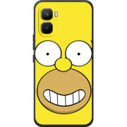 Чохол BoxFace Infinix GT 50 Pro 