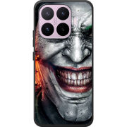 Чохол BoxFace Xiaomi 17T Prankster
