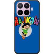 Чохол BoxFace Xiaomi 17T 