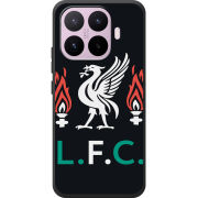 Чохол BoxFace Xiaomi 17T L. F. C.
