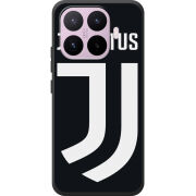 Чохол BoxFace Xiaomi 17T FC J