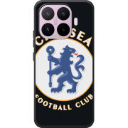 Чохол BoxFace Xiaomi 17T FC Chelsea