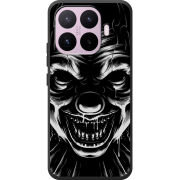 Чохол BoxFace Xiaomi 17T 