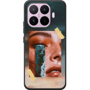 Чохол BoxFace Xiaomi 17T 