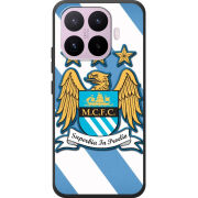 Чохол BoxFace Xiaomi 17T 