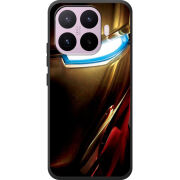Чохол BoxFace Xiaomi 17T 