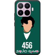 Чохол BoxFace Xiaomi 17T siquid game 456