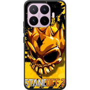 Чохол BoxFace Xiaomi 17T StandOff 2 gold