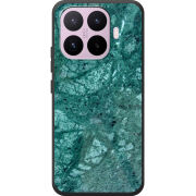 Чохол BoxFace Xiaomi 17T 